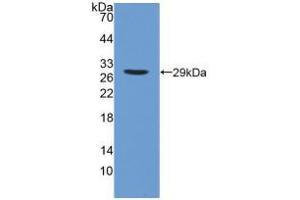 Western blot analysis of recombinant Human iPLA2. (PNPLA2 抗体  (AA 484-701))