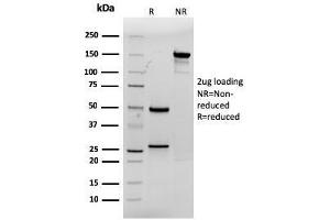 SDS-PAGE Analysis Purified CDX2 Mouse Monoclonal Antibody (rCDX2/1690). (Recombinant CDX2 抗体  (AA 150-249))