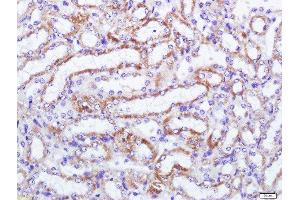 Paraformaldehyde-fixed, paraffin embedded mouse kidney tissue, Antigen retrieval by boiling in sodium citrate buffer(pH6) for 15min, Block endogenous peroxidase by 3% hydrogen peroxide for 30 minutes, Blocking buffer (normal goat serum) at 37°C for 20min, Antibody incubation with MCSF Receptor Polyclonal Antibody, Unconjugated  at 1:500 overnight at 4°C, followed by a conjugated secondary and DAB staining (CSF1R 抗体  (AA 201-300))