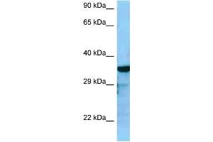 WB Suggested Anti-RGS4 Antibody Titration: 1. (RGS4 抗体  (C-Term))