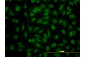 Immunofluorescence of monoclonal antibody to YY1 on HeLa cell. (YY1 抗体  (AA 221-320))