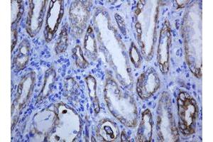 Image no. 2 for anti-Keratin 5 (KRT5) (AA 1-273) antibody (ABIN1490696) (Cytokeratin 5 抗体  (AA 1-273))