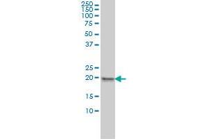 MPHOSPH6 monoclonal antibody (M01), clone 1D8-2A8 Western Blot analysis of MPHOSPH6 expression in HeLa . (MPHOSPH6 抗体  (AA 1-160))