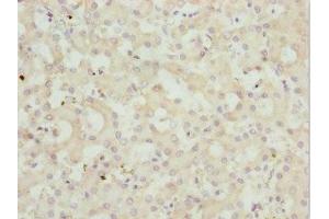 Immunohistochemistry of paraffin-embedded human liver tissue using ABIN7162962 at dilution of 1:100 (PEX3 抗体  (AA 144-373))
