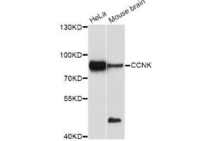 Western blot analysis of extracts of various cell lines, using CCNK Antibody (ABIN5997384) at 1/1000 dilution. (Cyclin K 抗体)