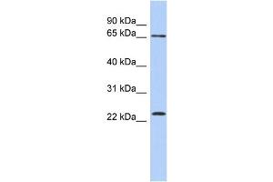 WB Suggested Anti-ZNF428 Antibody Titration: 0. (ZNF428 抗体  (N-Term))