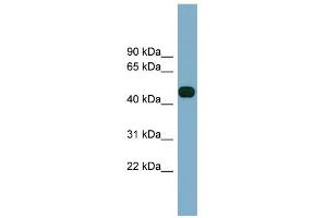 WB Suggested Anti-ABHD12 Antibody Titration:  0. (ABHD12 抗体  (Middle Region))