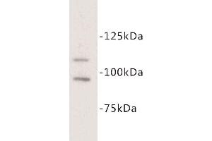 Western Blotting (WB) image for anti-Mast/stem Cell Growth Factor Receptor (KIT) antibody (ABIN1854841) (KIT 抗体)