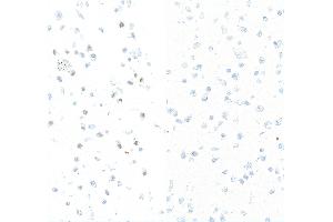 Immunocytochemistry (ICC) image for anti-Replication Protein A2, 32kDa (RPA2) (pSer4), (pSer8) antibody (ABIN7453379) (Recombinant RPA2 抗体  (pSer4, pSer8))