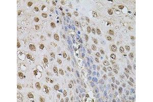 Immunohistochemistry of paraffin-embedded Human esophagus using Cyclin A2 Polyclonal Antibody at dilution of 1:100 (40x lens). (Cyclin A 抗体)