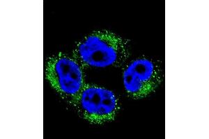 Confocal immunofluorescent analysis of M1 Antibody (Center) 2036c with  cell followed by Alexa Fluor 488-conjugated goat anti-rabbit lgG (green). (AP1M1 抗体  (AA 199-227))