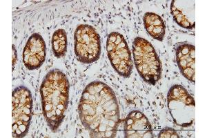 Immunoperoxidase of monoclonal antibody to DARS on formalin-fixed paraffin-embedded human colon. (DARS 抗体  (AA 393-500))