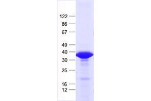 Validation with Western Blot (KCTD13 Protein (His tag))