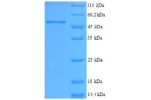 Gastric Intrinsic Factor (Vitamin B Synthesis) (GIF) (AA 19-417) protein (His tag)