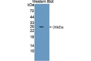 Western blot analysis of the recombinant protein. (ARNTL 抗体  (AA 1-169))