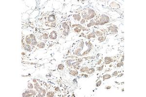 anti-Diacylglycerol Kinase, zeta (DGKZ) (AA 1067-1117) antibody