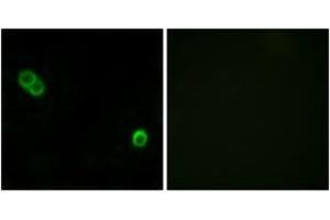 Immunofluorescence analysis of MCF7 cells, using PHCA Antibody. (ACER3 抗体  (AA 171-220))