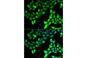Immunofluorescence analysis of A549 cell using KIF2B antibody. (KIF2B 抗体)