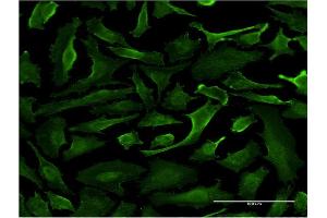 Immunofluorescence of monoclonal antibody to SRGAP1 on HeLa cell. (SRGAP1 抗体  (AA 952-1050))
