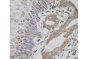 Immunohistochemistry (Paraffin-embedded Sections) (IHC (p)) image for anti-tRNA Methyltransferase 2 Homolog A (TRMT2A) antibody (ABIN7261896)