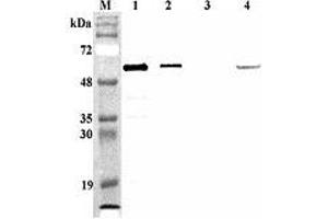 Western blot analysis of mouse FTO using anti-FTO (mouse), pAb  at 1:4,000 dilution. (FTO 抗体)
