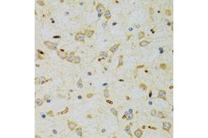 Immunohistochemistry of paraffin-embedded rat brain using SRP19 antibody (ABIN2560139) at dilution of 1:100 (40x lens). (SRP19 抗体)