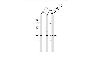 All lanes : Anti-OR2AE1 Antibody (C-term) at 1:1000 dilution Lane 1: U-87 MG whole cell lysate Lane 2: U-2OS whole cell lysate Lane 3: MDA-MB-231 whole cell lysate Lysates/proteins at 20 μg per lane. (Olfactory Receptor, Family 2, Subfamily AE, Member 1 (OR2AE1) (AA 278-312), (C-Term) 抗体)
