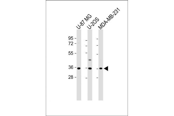 Olfactory Receptor, Family 2, Subfamily AE, Member 1 (OR2AE1) (AA 278-312), (C-Term) 抗体