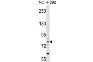 Western Blotting (WB) image for anti-Cartilage Acidic Protein 1 (CRTAC1) antibody (ABIN2999928) (CRTAC1 抗体)