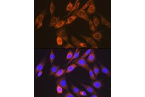 Immunofluorescence analysis of NIH-3T3 cells using  Rabbit mAb (ABIN7265412) at dilution of 1:100 (40x lens). (ACVRL1 抗体)