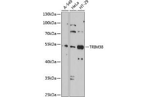 Western blot analysis of extracts of various cell lines, using TRIM38 antibody (ABIN1683145, ABIN3016312, ABIN3016313 and ABIN6219714) at 1:1000 dilution. (TRIM38 抗体  (AA 266-465))