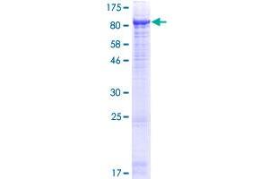 Image no. 1 for Membrane Metallo-Endopeptidase (MME) (AA 1-750) protein (GST tag) (ABIN1311049) (MME Protein (AA 1-750) (GST tag))