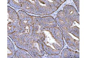 IHC analysis of MRPS22 using anti-MRPS22 antibody (ABIN7600613). (MRPS22 抗体  (AA 21-329))