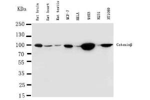 Anti-beta Catenin antibody, Western blotting Lane 1: Rat Brain Tissue Lysate Lane 2: Rat Heart Tissue Lysate Lane 3: Rat Testis Tissue Lysate Lane 4: MCF-7 Cell Lysate Lane 5: HELA Cell Lysate Lane 6: M453 Cell Lysate Lane 7: M231 Cell Lysate  Lane 8: HT1080 Cell Lysate (CTNNB1 抗体  (N-Term))