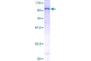 Image no. 2 for Unc-51-Like Kinase 4 (ULK24) (AA 1-580) protein (GST tag) (ABIN1324629)