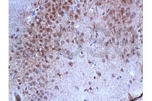 Formalin-fixed and paraffin embedded rat brain tissue with labeled Anti-Phospho-Estrogen Receptor alpha (Ser167) Polyclonal Antibody, Unconjugated (ABIN729493) at 1:200, followed by conjugation to the secondary antibody and DAB staining (Estrogen Receptor alpha 抗体  (pSer167))