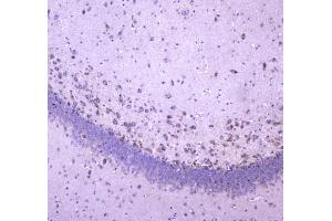 Immunohistochemistry (IHC) image for anti-WW Domain Containing Oxidoreductase (WWOX) antibody (ABIN5708495)