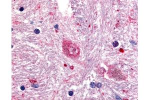 Anti-GPR88 antibody IHC of human brain, caudate. (GPR88 抗体  (Cytoplasmic Domain))