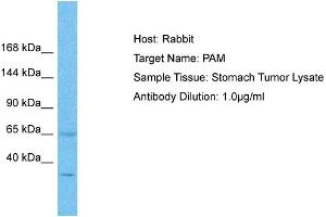 Host: Rabbit Target Name: PAM Sample Type: Stomach Tumor lysates Antibody Dilution: 1. (PAM 抗体  (C-Term))