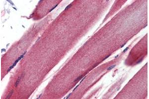 Human Skeletal Muscle (formalin-fixed, paraffin-embedded) stained with GSTM2 antibody ABIN462231 followed by biotinylated goat anti-rabbit IgG secondary antibody ABIN481713, alkaline phosphatase-streptavidin and chromogen. (GSTM2 抗体  (AA 71-120))
