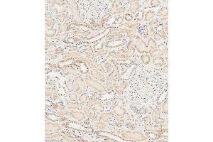 Immunohistochemical analysis of paraffin-embedded human kidney tissue using (ABIN1537780 and ABIN2848638) performed on the Leica® BOND RXm. (RAB28 抗体  (AA 119-147))