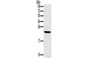 Gel: 12 % SDS-PAGE, Lysate: 40 μg, Lane: Mouse liver tissue, Primary antibody: ABIN7130217(MED22 Antibody) at dilution 1/800, Secondary antibody: Goat anti rabbit IgG at 1/8000 dilution, Exposure time: 15 seconds (MED22 抗体)