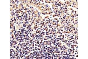 Immunohistochemical analysis of paraffin-embedded human spleen using beta-Actin antibody at 1:25 dilution. (beta Actin 抗体)