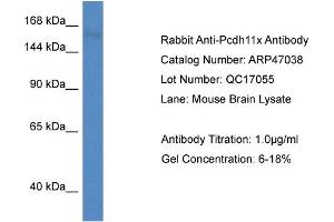 Western Blotting (WB) image for anti-Protocadherin 11 (PCDH11) (Middle Region) antibody (ABIN2782817) (PCDH11X 抗体  (Middle Region))