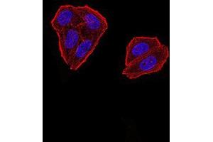 Immunofluorescence analysis of Hela cells using ZFP91 mouse mAb. (ZFP91 抗体  (AA 162-304))