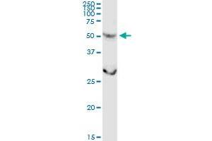 CSGALNACT2 MaxPab rabbit polyclonal antibody. (CSGALNACT2 抗体  (AA 1-542))