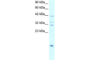 WB Suggested Anti-NFKBIA Antibody Titration:  0. (NFKBIA 抗体  (N-Term))