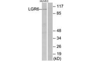 Western blot analysis of extracts from HuvEc cells, using LGR6 Antibody. (LGR6 抗体  (AA 471-520))