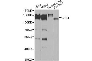 Western blot analysis of extracts of various cell lines, using CAST antibody (ABIN6290228) at 1:1000 dilution. (Calpastatin 抗体)