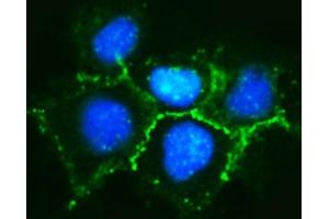 IF analysis of delta 1 Catenin/CAS/CTNND1 using anti-delta 1 Catenin/CAS/CTNND1 antibody (ABIN7602221).
